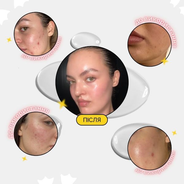 Пристрій для домашнього догляду за шкірою 6 в 1 Medicube AGE-R Booster Pro (Black) 10816 фото